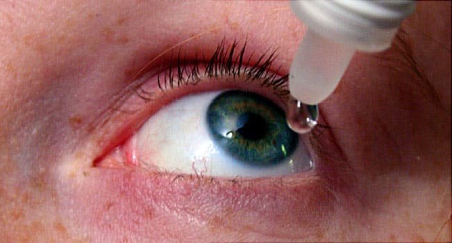 Common Causes of Dry Eyes